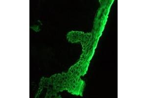 Image no. 2 for anti-pan Keratin (panKRT) antibody (ABIN959483) (pan Keratin anticorps)