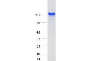 Validation with Western Blot