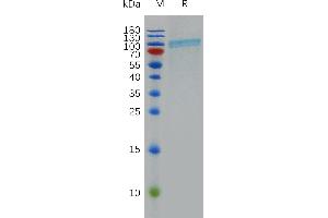 Human CD39 Protein, hFc Tag on SDS-PAGE under reducing condition.