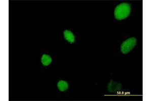 Immunofluorescence of purified MaxPab antibody to YEATS4 on HeLa cell. (GAS41 anticorps  (AA 1-227))