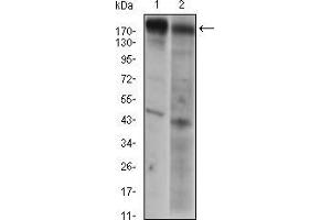 Western blot analysis using EGFR mouse mAb against A431 (1) AND Hela (2) cell lysate. (EGFR anticorps  (AA 693-893))