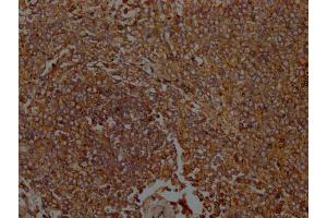 IHC image of ABIN7156538 diluted at 1:100 and staining in paraffin-embedded Human spleen tissue performed on a Leica BondTM system. (ICAM-3/CD50 anticorps  (AA 200-547))