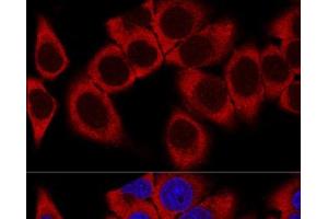 Confocal immunofluorescence analysis of HeLa cells using RPL36AL Polyclonal Antibody at dilution of 1:100. (RPL36AL anticorps)