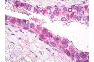 Anti-PSMD11 antibody IHC of human prostate.