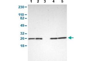Western Blot analysis of (1) human cell line RT-4, (2) human cell line U-251MG sp, (3) human plasma (IgG/HSA depleted), (4) human liver tissue, and (5) human tonsil tissue. (PARK7/DJ1 anticorps  (AA 40-177))