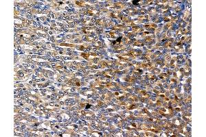 ABIN6260715 and ABIN6278829 at 1/100 staining rat stomach tissue by IHC-P. (CDK5RAP1 anticorps  (C-Term))