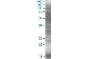 RPA3 transfected lysate. (RPA3 293T Cell Transient Overexpression Lysate(Denatured))