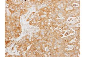 IHC-P Image Immunohistochemical analysis of paraffin-embedded human colon carcinoma, using Tuftelin 1, antibody at 1:250 dilution.