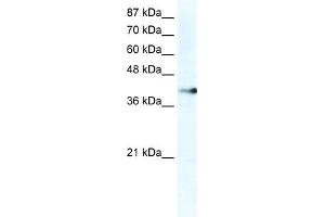 WB Suggested Anti-ZNF556 Antibody Titration:  2. (ZNF556 anticorps  (C-Term))
