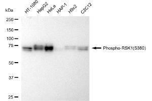 Western blotting analysis using Phospho-RSK1(S380) antibody (ABIN7800230).