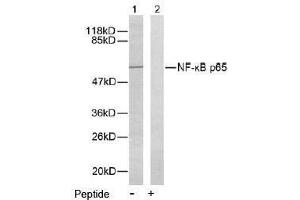 Image no. 2 for anti-Nuclear Factor-kB p65 (NFkBP65) (Ser276) antibody (ABIN197110) (NF-kB p65 anticorps  (Ser276))