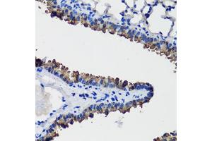 Immunohistochemistry of paraffin-embedded mouse lung using SCGB1 antibody (6997) at dilution of 1:100 (40x lens).