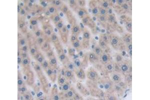 IHC-P analysis of Rat Tissue, with DAB staining. (CCL22 anticorps  (AA 27-92))