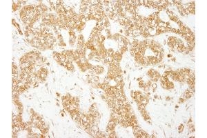 Immunohistochemistry (IHC) image for anti-Early Endosome Antigen 1 (EEA1) (AA 100-150) antibody (ABIN7454791) (EEA1 anticorps  (AA 100-150))