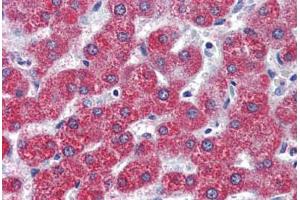 Human Liver (formalin-fixed, paraffin-embedded) stained with LPAR3 antibody ABIN399993 at 5 ug/ml followed by biotinylated goat anti-rabbit IgG secondary antibody ABIN481713, alkaline phosphatase-streptavidin and chromogen.