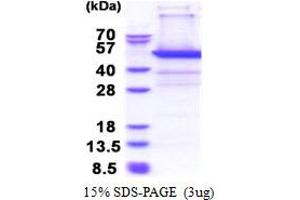 SDS-PAGE (SDS) image for Proteasome (Prosome, Macropain) 26S Subunit, Non-ATPase, 11 (PSMD11) (AA 1-422) protein (His tag) (ABIN5853429) (PSMD11 Protein (AA 1-422) (His tag))
