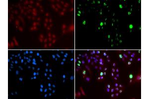 Immunofluorescence analysis of GFP-RNF168 transgenic U2OS cell using FANCD2 antibody. (FANCD2 anticorps  (AA 1-230))