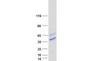 Validation with Western Blot