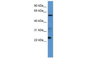 WB Suggested Anti-CPNE9 Antibody Titration: 0. (CPNE9 anticorps  (C-Term))