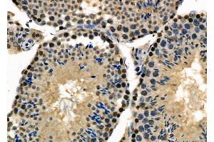 ABIN6264007 and ABIN6277984 at 1/100 staining Mouse testis tissue by IHC-P. (Poly(A) Binding Protein, Cytoplasmic, Pseudogene 2 (PABPCP2) (C-Term) anticorps)