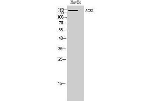 Western Blotting (WB) image for anti-Angiotensin I Converting Enzyme (Peptidyl-Dipeptidase A) 1 (ACE) (Internal Region) antibody (ABIN3183143)