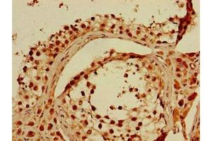 Immunohistochemistry of paraffin-embedded human testis tissue using ABIN7156122 at dilution of 1:100