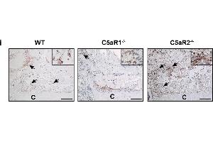 Quantification and representative immunohistological staining of immune cells in the fracture haematoma/callus.