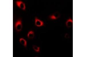 Immunofluorescent analysis of SM22 alpha staining in HT29 cells.