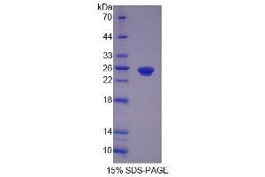 SDS-PAGE (SDS) image for Peroxisomal Biogenesis Factor 1 (PEX1) (AA 62-219) protein (His tag) (ABIN4989490)