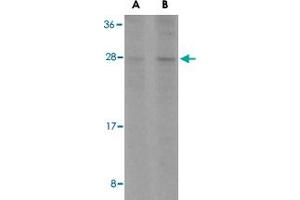 Western blot analysis of BCL2L1 in A-549 cell lysates with BCL2L1 polyclonal antibody  at (A) 1 and (B) 2 ug/mL . (BCL2L1 anticorps  (C-Term))