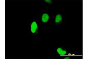 Immunofluorescence of monoclonal antibody to SERTAD1 on HeLa cell. (SERTAD1 anticorps  (AA 1-236))