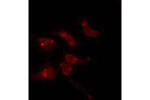 ABIN6274100 staining 293T by IF/ICC. (PHF1 anticorps  (Internal Region))