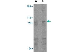 Western blot analysis of TMC6 in human spleen tissue lysate with TMC6 polyclonal antibody  at (A) 1 and (B) 2 ug/mL . (TMC6 anticorps  (Internal Region))