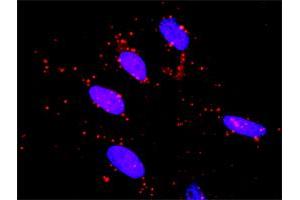 Proximity Ligation Analysis of protein-protein interactions between MAPK3 and RET.