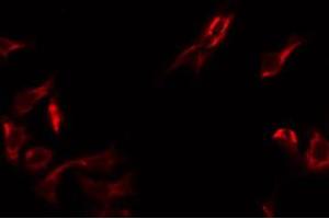 ABIN6275063 staining HT29 by IF/ICC.