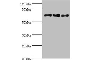 Western blot All lanes: NCL antibody at 8 μg/mL Lane 1: Jurkat whole cell lysate Lane 2: Hela whole cell lysate Lane 3: 293T whole cell lysate Secondary Goat polyclonal to rabbit IgG at 1/10000 dilution Predicted band size: 77 kDa Observed band size: 77 kDa