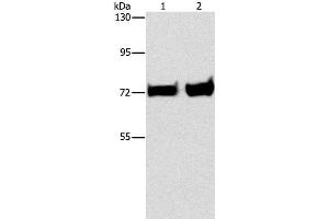 Western Blot analysis of Mouse liver and kidney tissue using PCK1 Polyclonal Antibody at dilution of 1:375 (PCK1 anticorps)