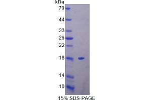 Image no. 1 for Profilin 3 (PFN3) (AA 1-133) protein (His tag) (ABIN4990351)