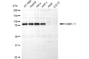 Western blotting analysis using OSBPL11 antibody (ABIN7799715).