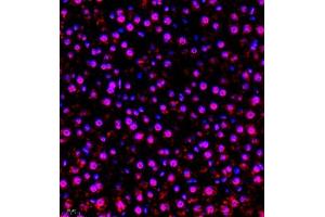 Immunofluorescence of paraffin embedded rat liver using RBAK (ABIN7075383) at dilution of 1:400 (400x lens) (RBAK anticorps)