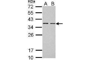 WB Image BCL7A antibody [C2C3], C-term detects BCL7A protein by Western blot analysis.