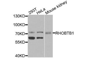 Western blot analysis of extracts of various cell lines, using RHOBTB1 antibody (ABIN6003667) at 1/1000 dilution.