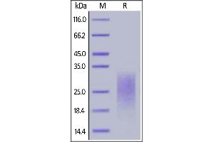 Biotinylated Human CD24, His,Avitag on  under reducing (R) condition.