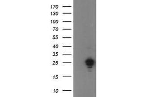 Image no. 1 for anti-Ubiquitin-Conjugating Enzyme E2E 3 (UBE2E3) antibody (ABIN1501621) (UBE2E3 anticorps)