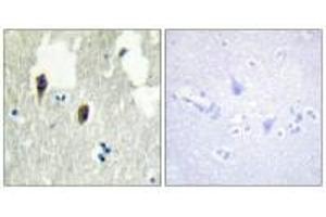 Immunohistochemistry analysis of paraffin-embedded human brain tissue, using KLHL3 antibody.