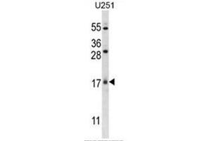 C1orf144 Antibody (N-term) western blot analysis in U251 cell line lysates (35µg/lane).