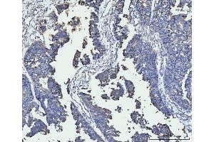 IHC analysis of FACL4/ACSL4 using anti-FACL4/ACSL4 antibody (ABIN7602779).