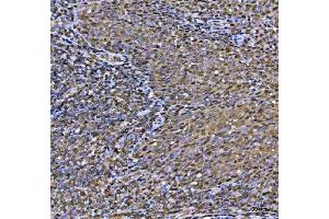 IHC analysis of MAT2A using anti-MAT2A antibody (ABIN7599120). (MAT2A anticorps  (AA 1-229))