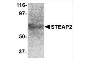 Western blot analysis of STEAP2 in human prostate tissue lysate with this product at 1 μg/ml. (STEAP2 anticorps  (C-Term))