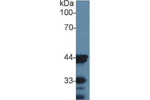Detection of ACTC1 in Mouse Skin lysate using Monoclonal Antibody to Actin Alpha 1, Cardiac Muscle (ACTC1) (ACTC1 anticorps  (AA 156-368))